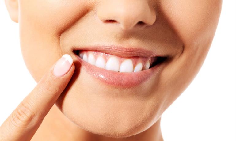استفاده از لاک سفیدکننده دندان؛ مزایا و عوارض آن
